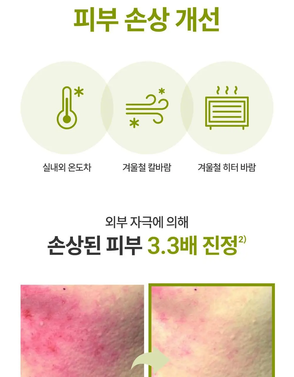 [대용량] 제로이드 인텐시브 크림 80ml 기획 (+50ml) 상세페이지 28